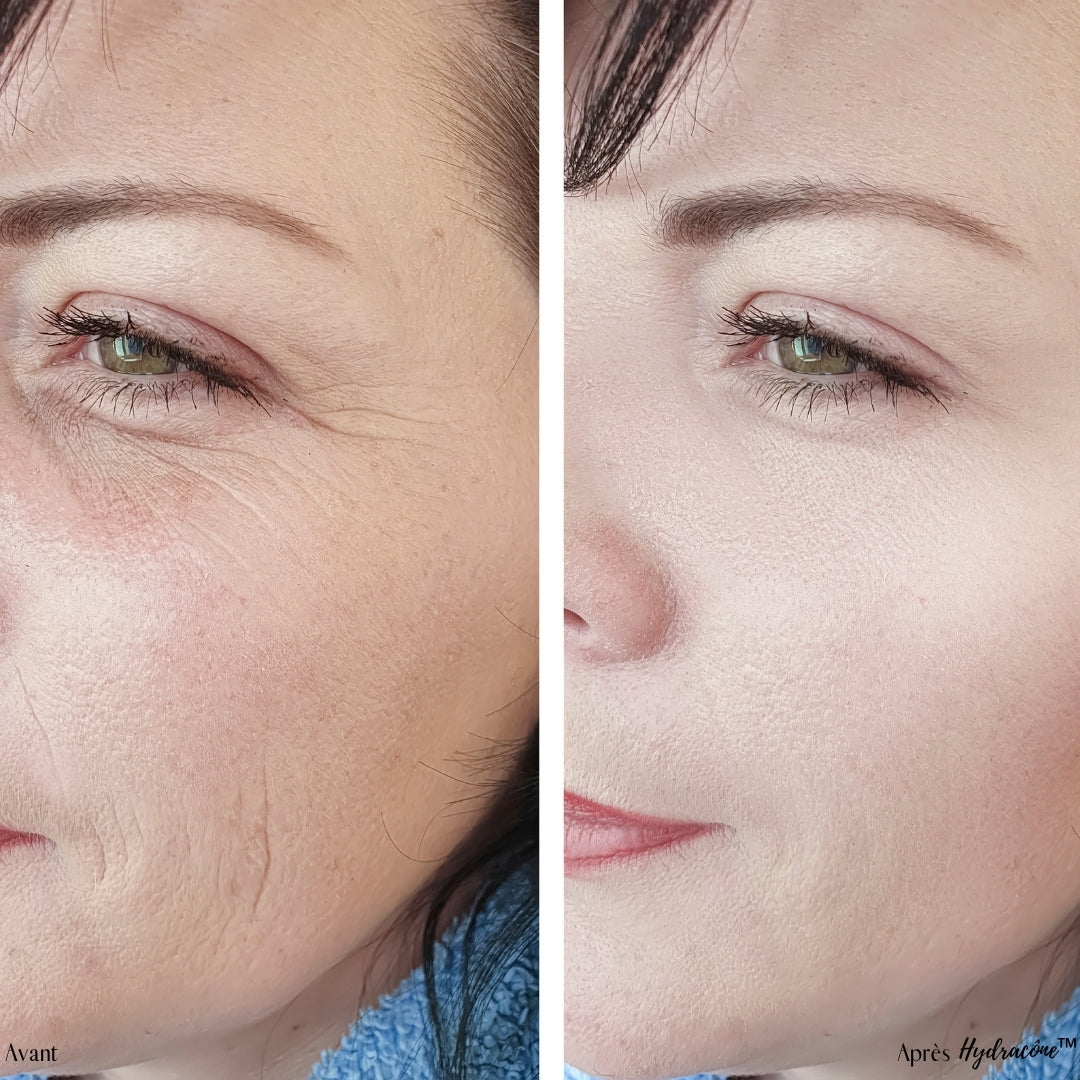 Patchs yeux hybride Hydracône™